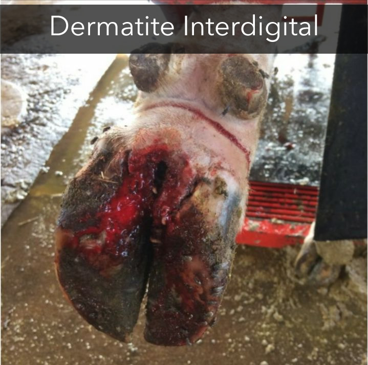 dermatite-interdigital