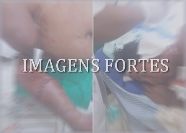 Peão é brutalmente atacado por onças, imagens fortes!